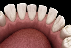 a digital design of a model of a mouth showing misspaced teeth