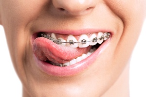 person with braces