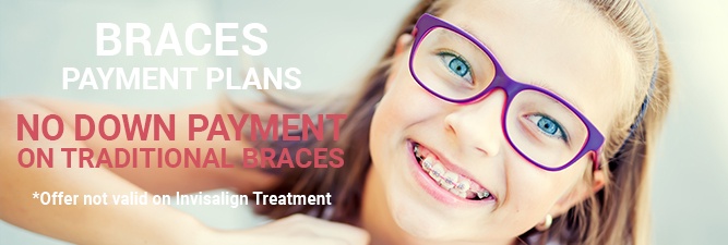 Braces payment plans coupon