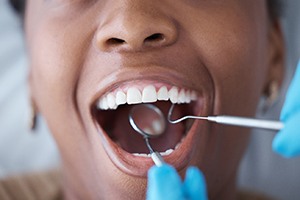 a person having their mouth examined by a dentist