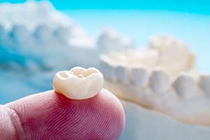 a person holding a dental crown in Dallas on their finger