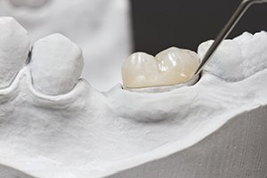 a porcelain dental crown on a plaster mold of a mouth