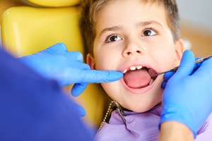 boy open mouth dentist