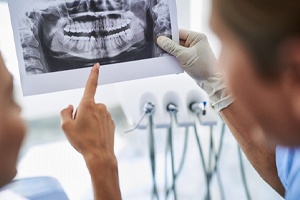 a dentist consulting about dentures in Dallas with a patient