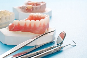 a plaster model of a mouth with full dentures resting on it