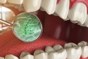 a digital illustration depicting bacteria within the mouth