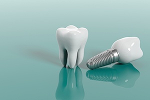Diagram of a dental implant in Dallas next to a tooth