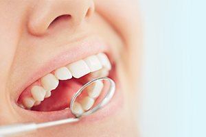 Closeup of smile during dental treatment