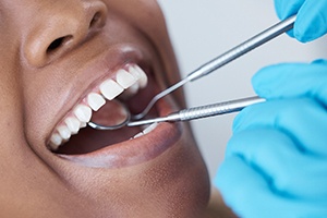 a person smiling as their dentist is examining their mouth