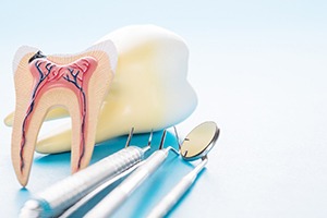 a model of a tooth showing the nerves and pulp