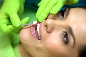 cosmetic dentist in Dallas placing a veneer onto a patient’s tooth 