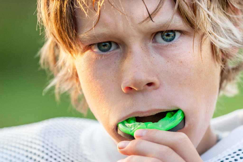 boy inserting athletic mouthguard