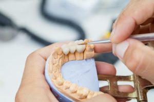 a lab technician making a dental bridge