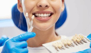 a dentist holding up a shade chart to a patient's smile